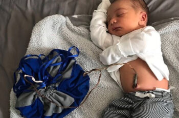 Little Baby Brings A ‘Placenta Bag’ Anywhere They Go And His Mom Doesn’t Mind The Haters